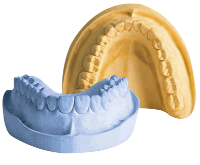 ELITE MODEL YESO TIPO III - Imagen 2